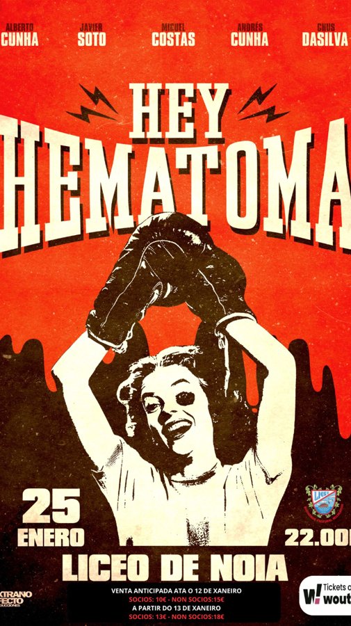 HEY HEMATOMA HEY HEMATOMA